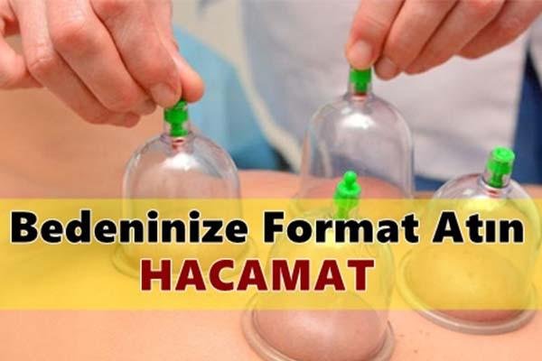 Seyri Şifa Hacamatın Faydaları